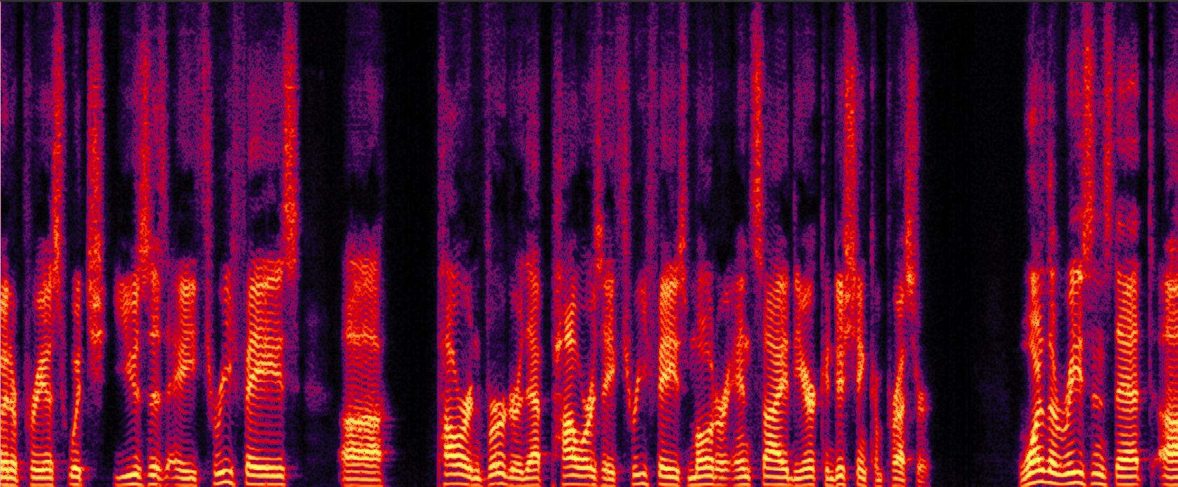 SenSE Enhanced Spectrogram