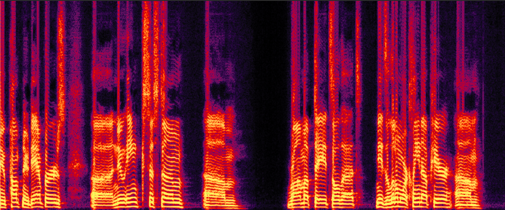 SenSE Enhanced Spectrogram